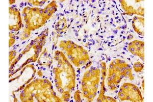Immunohistochemistry of paraffin-embedded human kidney tissue using ABIN7153179 at dilution of 1:100 (FZD1 抗体  (AA 125-225))