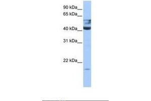 Image no. 1 for anti-Queuine tRNA-Ribosyltransferase 1 (QTRT1) (AA 45-94) antibody (ABIN6738529) (QTRT1 抗体  (AA 45-94))