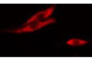 ABIN6267021 staining A-431 cells by IF/ICC. (TRHR 抗体)