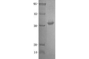 Western Blotting (WB) image for Oxidized Low Density Lipoprotein (Lectin-Like) Receptor 1 (OLR1) (Transcript Variant 2) protein (ABIN2727906)