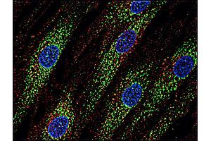Immunofluorescence staining of human skin fibroblasts with anti-CD63 (MEM-259 ; green) after co-incubation of living cells with human Transferrin - Dyomics 547; cell nuclei stained with DAPI (blue). (CD63 抗体  (APC))