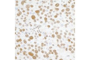 Immunohistochemistry (IHC) image for anti-H2A Histone Family, Member X (H2AFX) (C-Term) antibody (ABIN7449536) (H2AFX 抗体  (C-Term))