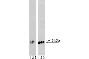 Western blot analysis of H2AX (pS139) in transformed human epithelioid carcinoma.