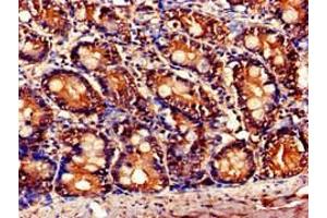 Immunohistochemistry of paraffin-embedded human small intestine tissue using ABIN7145827 at dilution of 1:100 (TNFAIP1 抗体  (AA 233-316))