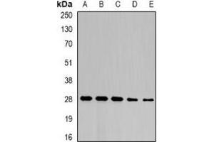 Western blot analysis of NFU1 expression in SW480 (A), mouse liver (B), mouse heart (C), rat liver (D), rat heart (E) whole cell lysates. (NFU1 抗体)