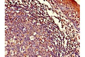 Immunohistochemistry of paraffin-embedded human tonsil tissue using ABIN7143153 at dilution of 1:100 (ASCC1 抗体  (AA 1-315))