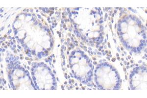 Detection of ZRF1 in Human Colon Tissue using Polyclonal Antibody to Zuotin Related Factor 1 (ZRF1) (DNAJC2 抗体  (AA 442-621))