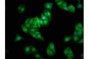 Immunofluorescence staining of HepG2 cells with ABIN7165127 at 1:333, counter-stained with DAPI. (BEX2 抗体  (AA 1-128))