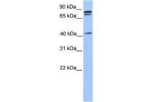SUZ12 antibody used at 0. (SUZ12 抗体  (C-Term))