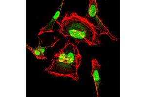 Immunofluorescence analysis of HeLa cells using CDK2 antibody (green). (CDK2 抗体)