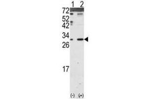 Image no. 2 for anti-Dickkopf 2 Homolog (DKK2) (N-Term) antibody (ABIN357069)