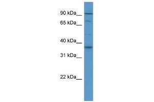 WB Suggested Anti-FGFR2 Antibody Titration: 0. (FGFR2 抗体  (Middle Region))