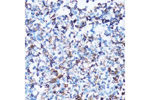 Immunohistochemistry of paraffin-embedded human tonsil using SPN antibody (ABIN5973813) at dilution of 1/100 (40x lens). (CD43 抗体)