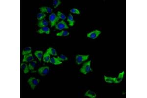 Immunofluorescence staining of Hela cells with ABIN7148294 at 1:166, counter-stained with DAPI. (MCC 抗体  (AA 479-611))