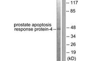 Western blot analysis of extracts from NIH-3T3 cells, using Prostate Apoptosis Response protein-4 Antibody. (PAWR 抗体  (AA 291-340))