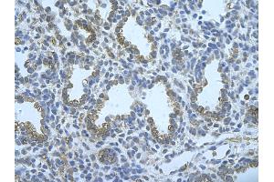Immunohistochemistry (IHC) image for anti-Fused in Sarcoma (FUS) (N-Term) antibody (ABIN2778717)
