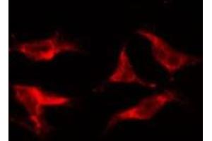ABIN6278181 staining HepG2 by IF/ICC. (ABAT 抗体  (Internal Region))