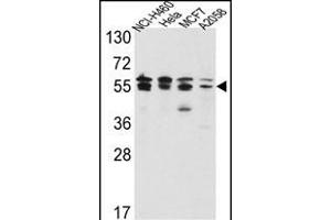 Western blot analysis of IDH2 Antibody (Center) (ABIN391584 and ABIN2841516) in NCI-,Hela,MCF7, cell line lysates(35 μg/lane). (IMPDH2 抗体  (AA 180-210))
