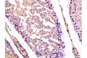 Formalin-fixed and paraffin embedded rat testis labeled with Anti-DDX43/CT13 Polyclonal Antibody, Unconjugated (ABIN716021) at 1:200 followed by conjugation to the secondary antibody and DAB staining. (DDX43 抗体  (AA 481-580))