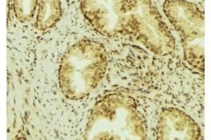 ABIN6276966 at 1/100 staining Mouse colon tissue by IHC-P. (RCAS1 抗体  (C-Term))