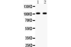 Anti- GRIA3 antibody, Western blotting All lanes: Anti GRIA3  at 0. (Glutamate Receptor 3 抗体  (AA 29-360))