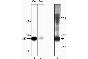 Immunoprecipitation/Western Blot analysis of p27 [Kip1]. (CDKN1B 抗体)