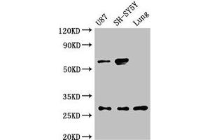 Western Blot Positive WB detected in: U87 whole cell lysate, SH-SY5Y whole cell lysate, Rat lung tissue All lanes: NEUROG2 antibody at 3 μg/mL Secondary Goat polyclonal to rabbit IgG at 1/50000 dilution Predicted band size: 29 kDa Observed band size: 29, 60 kDa (Neurogenin 2 抗体  (AA 194-262))