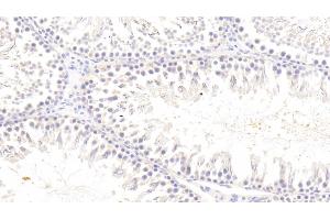 Detection of TREM2 in Rat Testis Tissue using Polyclonal Antibody to Triggering Receptor Expressed On Myeloid Cells 2 (TREM2) (TREM2 抗体  (AA 1-228))