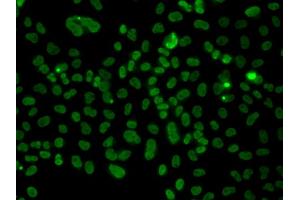Immunofluorescence analysis of A549 cells using PLCXD2 antibody. (PLCXD2 抗体)