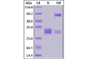 Human CD8A&CD8B Heterodimer Protein, His Tag&Tag Free on  under reducing (R) and ing (NR) conditions. (CD8 Protein (CD8) (AA 22-182) (His tag))