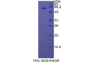 SDS-PAGE analysis of Rat Lipase, Hepatic Protein. (LIPC 蛋白)