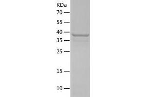 Western Blotting (WB) image for Syndecan 1 (SDC1) (AA 18-254) protein (His tag) (ABIN7125280)
