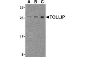 Image no. 1 for anti-Toll Interacting Protein (TOLLIP) (Middle Region) antibody (ABIN265154) (TOLLIP 抗体  (Middle Region))