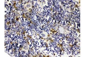 GC1q R was detected in paraffin-embedded sections of mouse spleen tissues using rabbit anti- GC1q R Antigen Affinity purified polyclonal antibody (Catalog # ) at 1 µg/mL. (C1QBP 抗体  (AA 190-282))