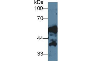 Western Blotting (WB) image for anti-Keratin 14 (KRT14) (AA 1-484) antibody (ABIN7442804)