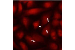 Immunofluorescence (IF) image for anti-Tubulin, beta 2B (TUBB2B) antibody (ABIN567612) (TUBB2B 抗体)