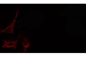 Immunofluorescence (fixed cells) (IF/ICC) image for anti-Collagen, Type XI, alpha 1 (COL11A1) (Internal Region) antibody (ABIN6260952)