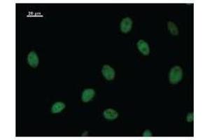 Immunostaining analysis in HeLa cells. (NRF2 抗体)