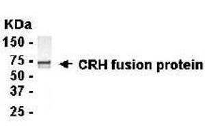 Image no. 1 for anti-Corticotropin Releasing Hormone (CRH) (AA 27-196) antibody (ABIN294738) (CRH 抗体  (AA 27-196))