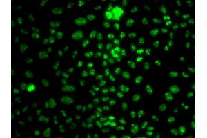 Immunofluorescence analysis of HeLa cells using MKI67 antibody (ABIN4904374). (Ki-67 抗体)