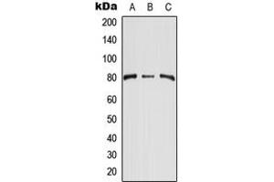 Western blot analysis of CD248 expression in HEK293T (A), NIH3T3 (B), H9C2 (C) whole cell lysates. (CD248 抗体  (Center))