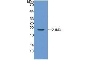 Detection of Recombinant MGA, Human using Polyclonal Antibody to Maltase-glucoamylase (MGAM) (Maltase-Glucoamylase (MGAM) (AA 213-392) 抗体)