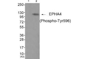 Western blot analysis of extracts from JK cells (Lane 2), using EPHA4 (Phospho-Tyr596) Antibody. (EPH Receptor A4 抗体  (pTyr596))