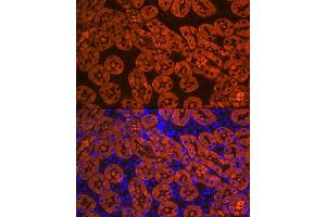 Immunofluorescence analysis of mouse kidney using FBP1 Rabbit mAb (ABIN7267269) at dilution of 1:100 (40x lens).