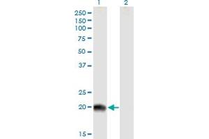 Western Blot analysis of RS1 expression in transfected 293T cell line by RS1 MaxPab polyclonal antibody. (RS1 抗体  (AA 1-224))
