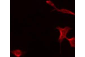 Immunofluorescence (fixed cells) (IF/ICC) image for anti-Protein tyrosine Phosphatase, Receptor-Type, Z Polypeptide 1 (PTPRZ1) (N-Term) antibody (ABIN6259162)