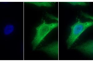 Detection of MTNR1A in Human HepG2 cell using Polyclonal Antibody to Melatonin Receptor 1A (MTNR1A) (Melatonin Receptor 1A 抗体  (AA 296-350))