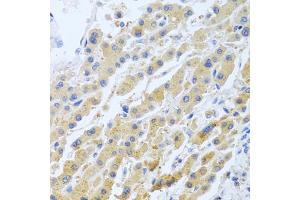 Immunohistochemistry of paraffin-embedded human liver using STC1 antibody (ABIN5975425) at dilution of 1/100 (40x lens). (Stanniocalcin 1 抗体)