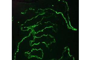 Image no. 1 for anti-Keratin 10 (KRT10) antibody (ABIN959490) (Keratin 10 抗体)