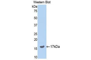 Western Blotting (WB) image for anti-serpin Peptidase Inhibitor, Clade A (Alpha-1 Antiproteinase, Antitrypsin), Member 6 (SERPINA6) (AA 267-390) antibody (ABIN1858271) (SERPINA6 抗体  (AA 267-390))